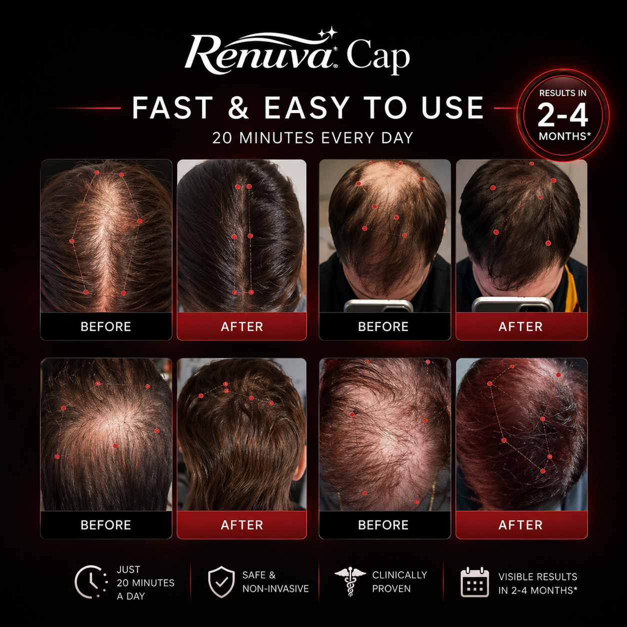 RENUVA™ Red Light Therapy Hair Regrowth Cap